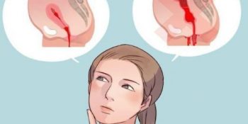 Hiện Tượng Hết Sản Dịch Lại Ra Máu Tươi Có Nguy Hiểm Không, BS Tư Vấn Update 09/2025