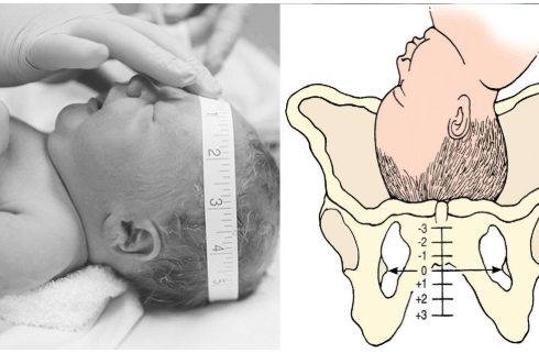 Đường Kính Lưỡng Đỉnh Thai 36 Tuần Và Những Chỉ Số Mẹ Cần Biết Update 11/2024