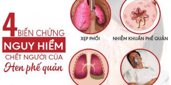 Trẻ Bị Hen Phế Quản Có Nguy Hiểm Không, Nên Ăn Gì Update 03/2025