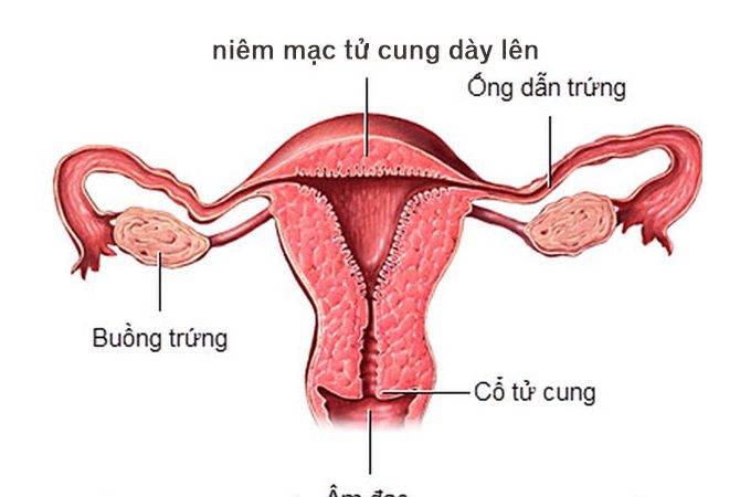 Niêm Mạc Tử Cung Dày 12mm Có Thai Không? Update 10/2024