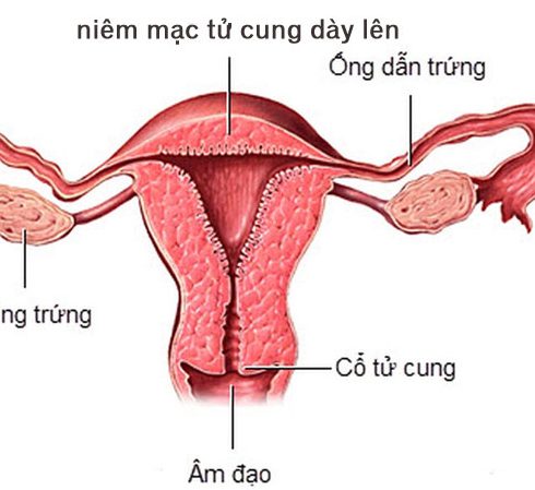 Niêm Mạc Tử Cung Dày Bao Nhiêu Là Bình Thường? Update 11/2024