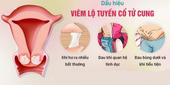 Những Điều Cần Biết Khi Bị Viêm Lộ Tuyến Cấp Độ 1 Update 10/2024